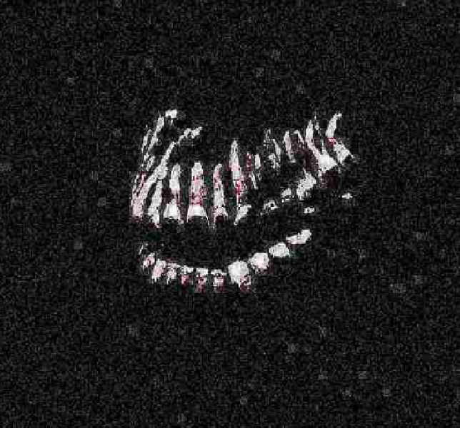 File:Deep-fried-teeth.png